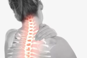 Cervicale cause sintomi rimedi