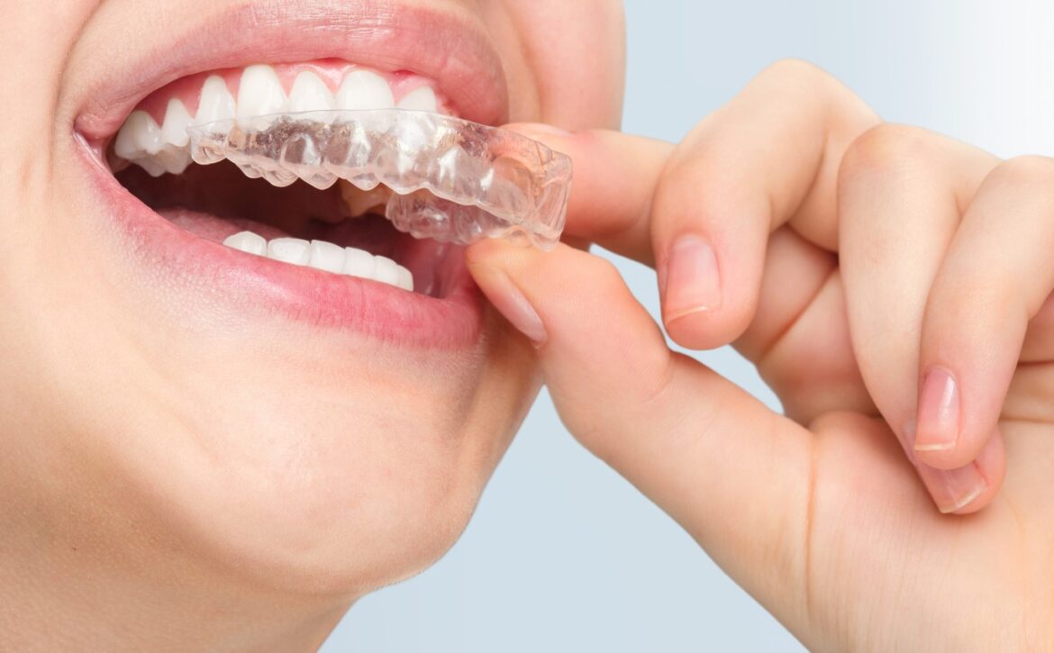 Smiling woman with silicone trainer close up.