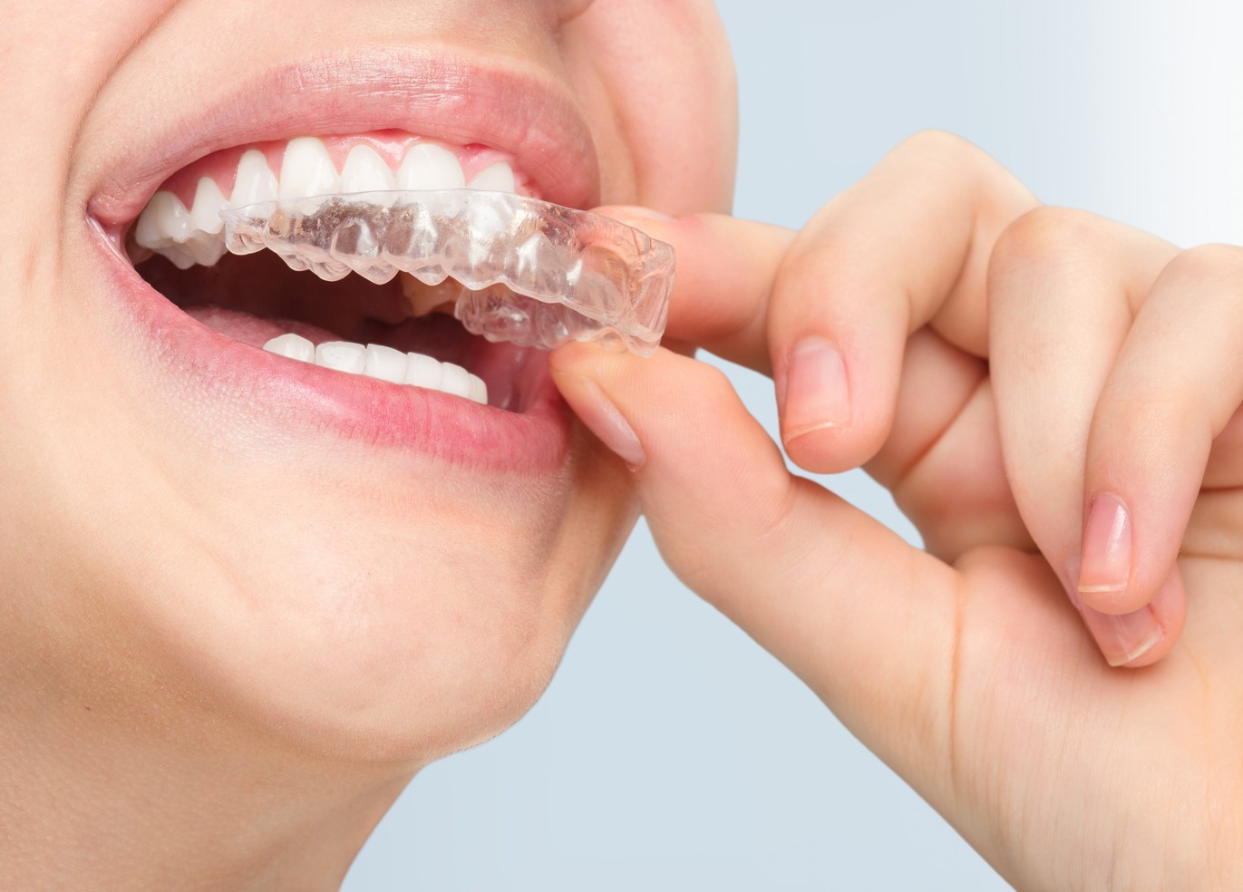 Smiling woman with silicone trainer close up.