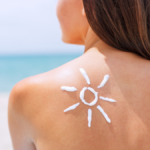 Dermatiti solari? Scopri come proteggere la tua pelle