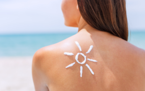 Dermatite solare