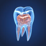 Endodonzia: cos’è e di cosa si occupa