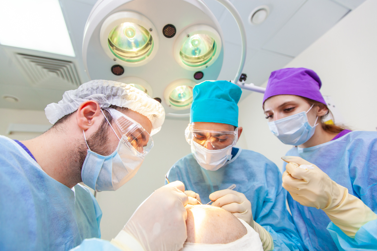 Baldness treatment. Hair transplant. Surgeons in the operating room carry out hair transplant surgery. Surgical technique that moves hair follicles from a part of the head