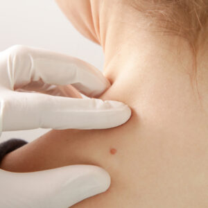 Dermatologia