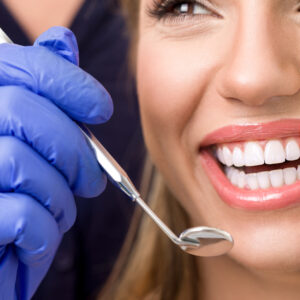 Pulizia dei denti professionale