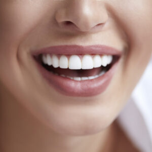 Estetica dentale
