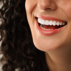Sbiancamento Dentale